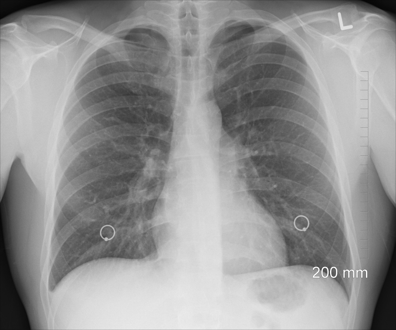 Difference between breathing and respiration