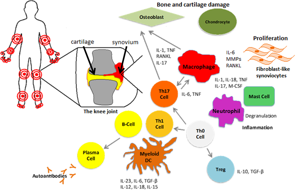 Rheumatoid Arthritis case study