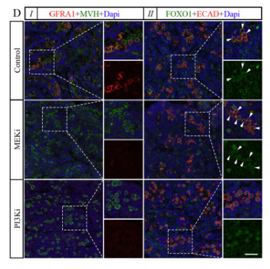 Immunofluorescent detection in cell profile report