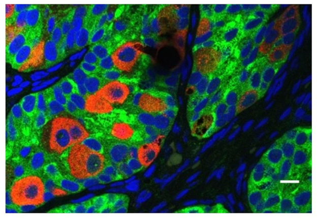 Presence of abnormal gonocytes in cell profile report